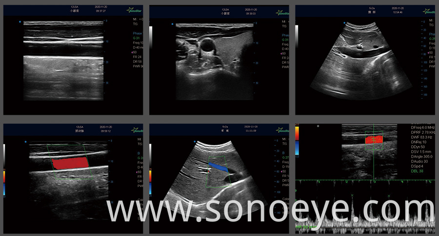 mini ultrasound